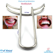 Load image into Gallery viewer, Dental Vestibulum Mouth Opener Gag Cheek Lip Retractors Surgical Oral Stainless
